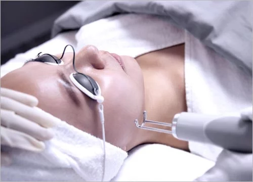 皮秒激光去斑: Understanding Pico Laser Treatment for Freckles and Pigmentation
